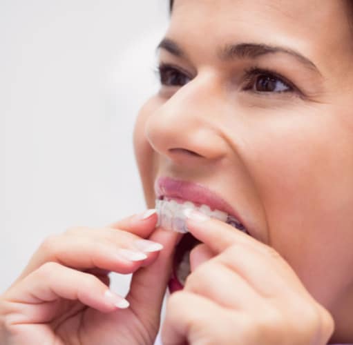 Invisalign Treatment in McMurray PA
