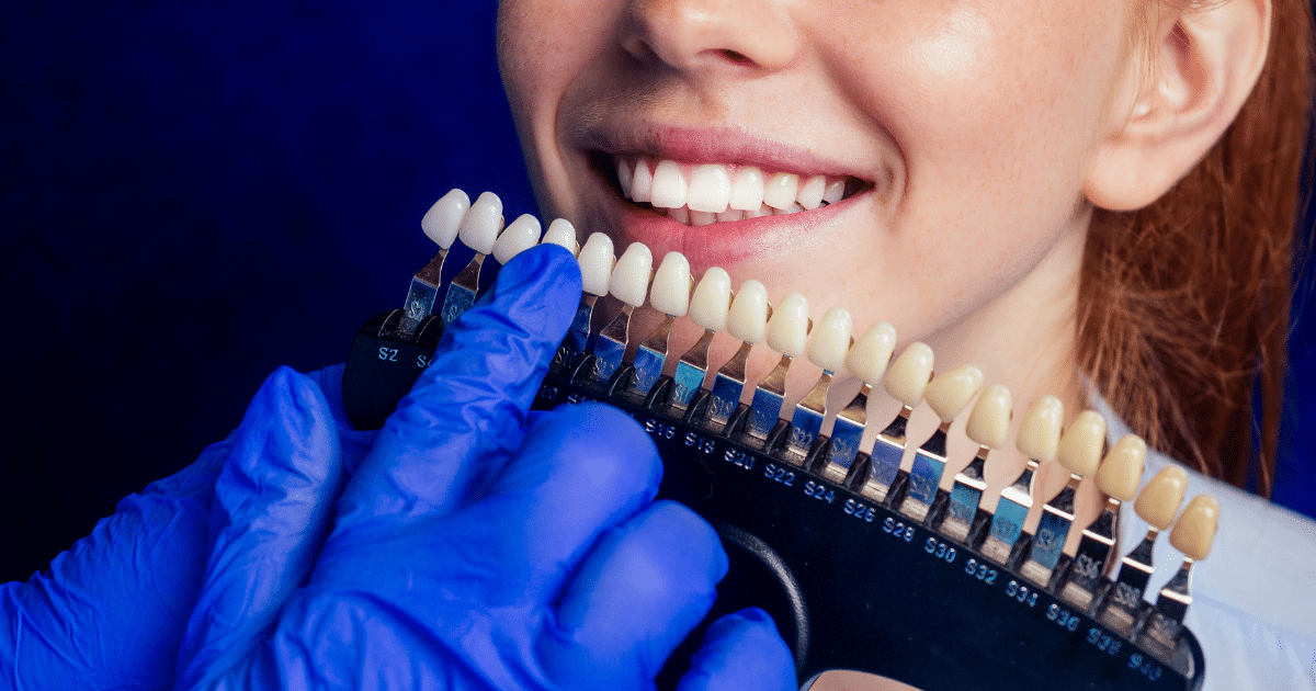 Porcelain-Veneers-for-Different-Dental-Issues